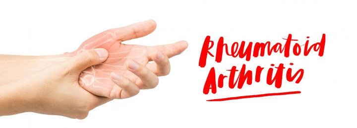 Mari mengenal lebih jauh: Rheumatoid Arthritis dan Bagaimana Menjaga Kesehatan Sendi bagi Penyintas AI